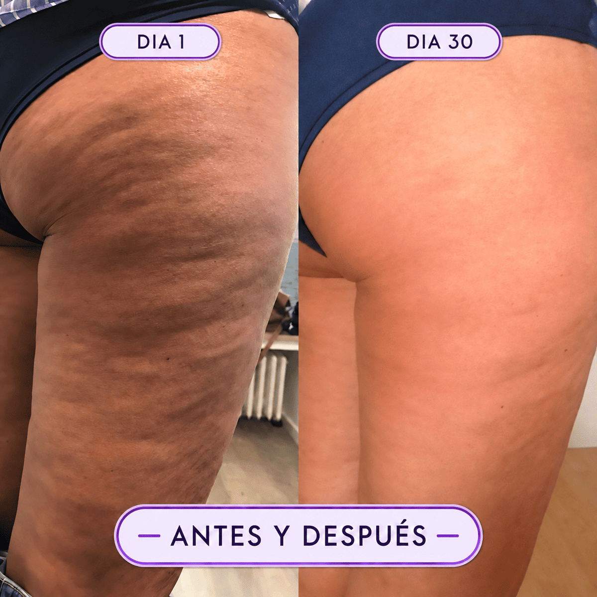 Celvia - Crema Anti Celulitica, Piel más lisa y firme