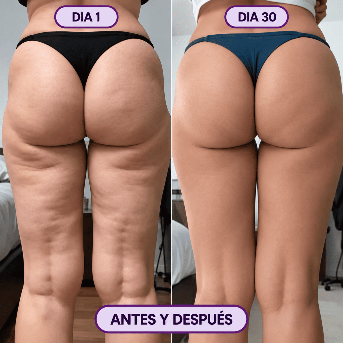 Celvia - Crema Anti Celulitica, Piel más lisa y firme